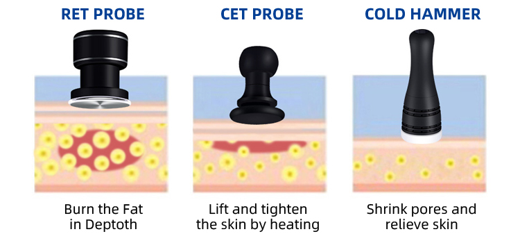Ret cet rf physical therapy weight loss body slimming machine 448khz+20khz RF315