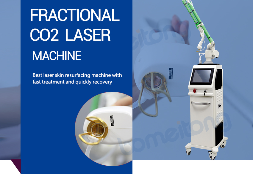 skin resurfacing 10600nm