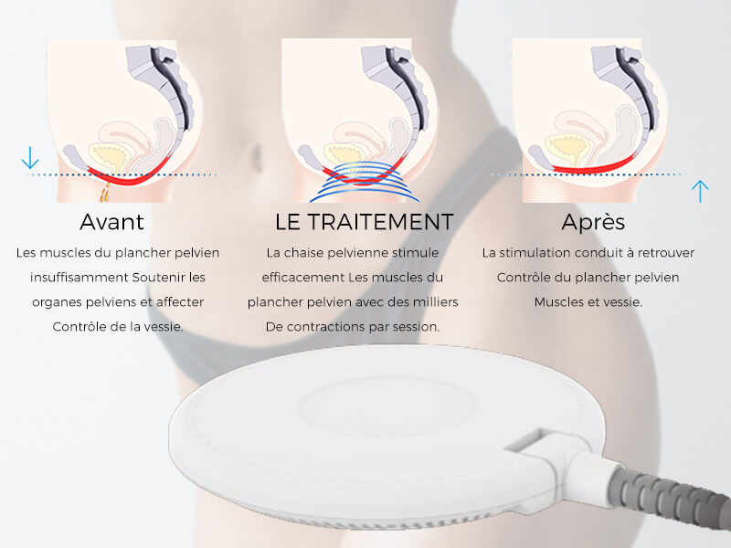 coussin de siège supérieur