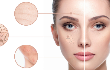 What You Need To Know Before Laser Skin Resurfacing（2）