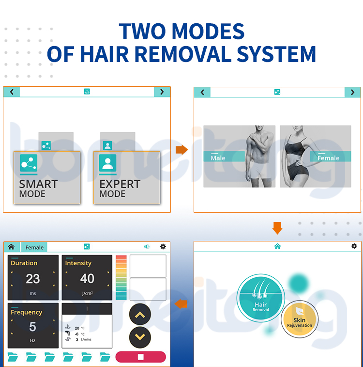 permanent unwanted hair removal