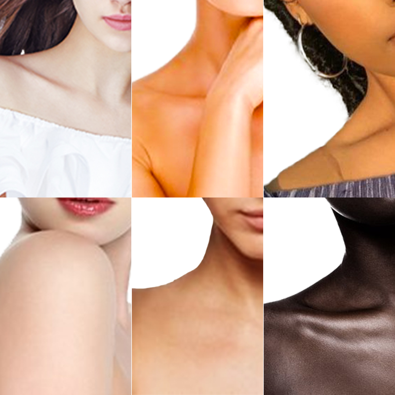 808nm diode laser hair removal machine