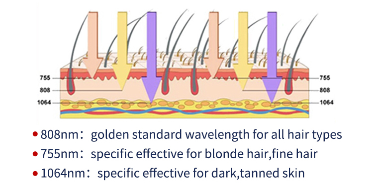 Buy Laser Diode Hair Removal