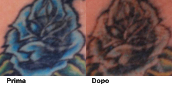 picosecond laser machine