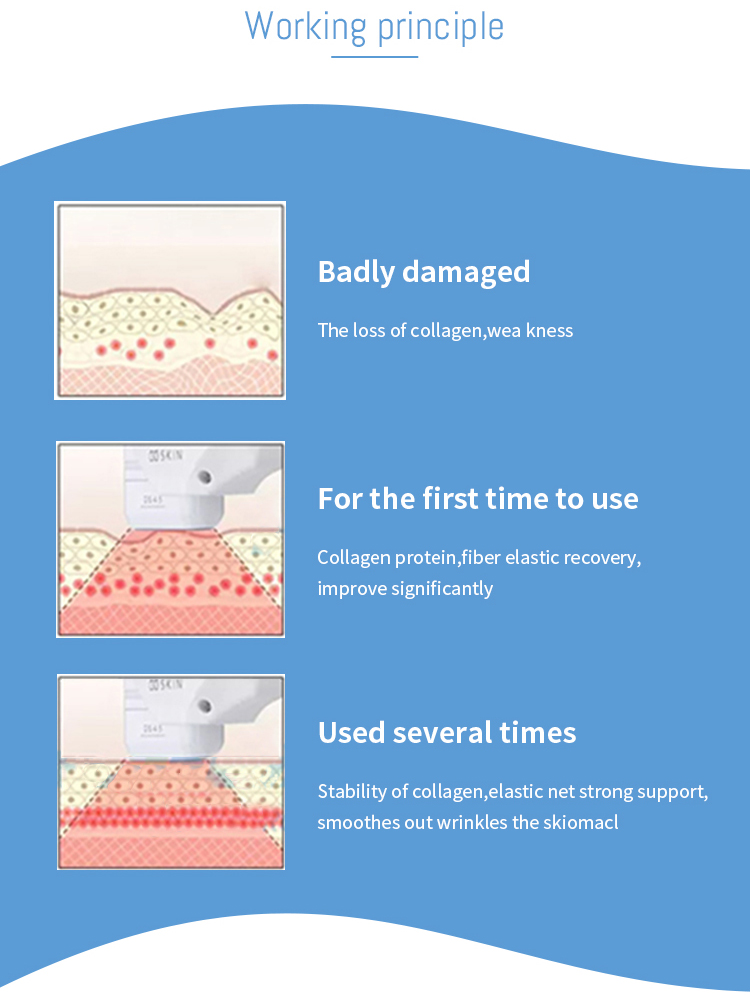 hifu machine for sale