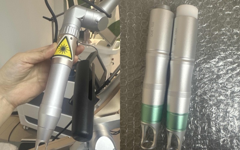 machine tattoo removal