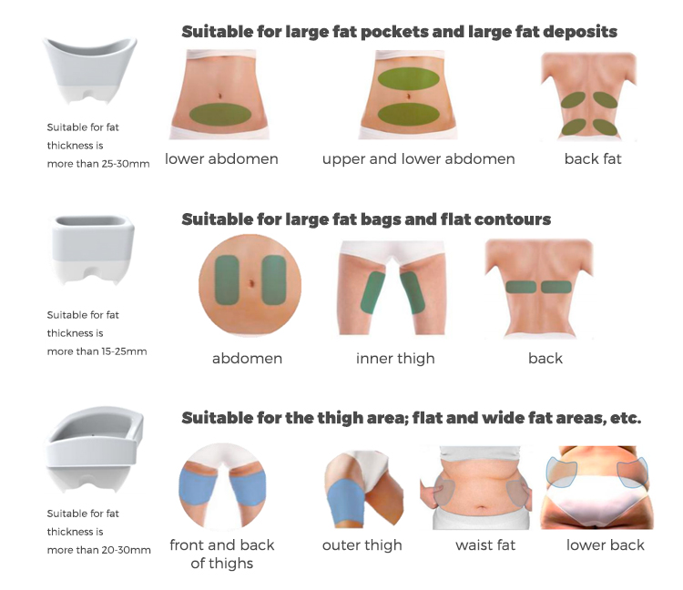 Fat Reducing Beauty&nbsp;Instrument