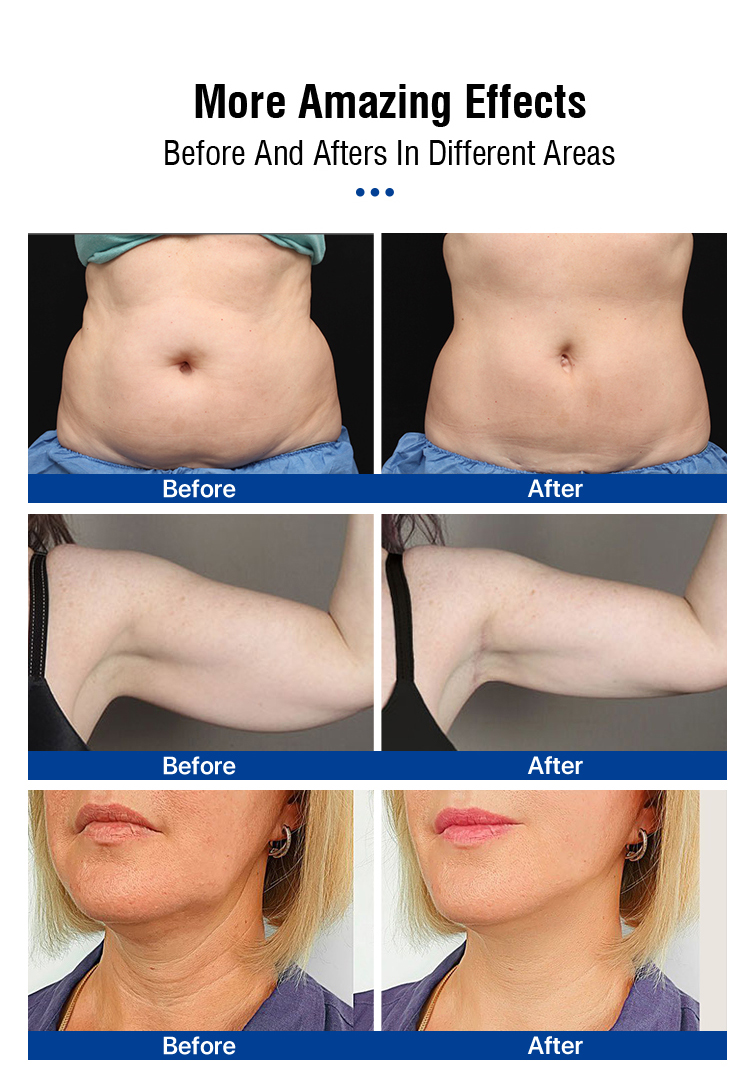 best thermogenic fat burner