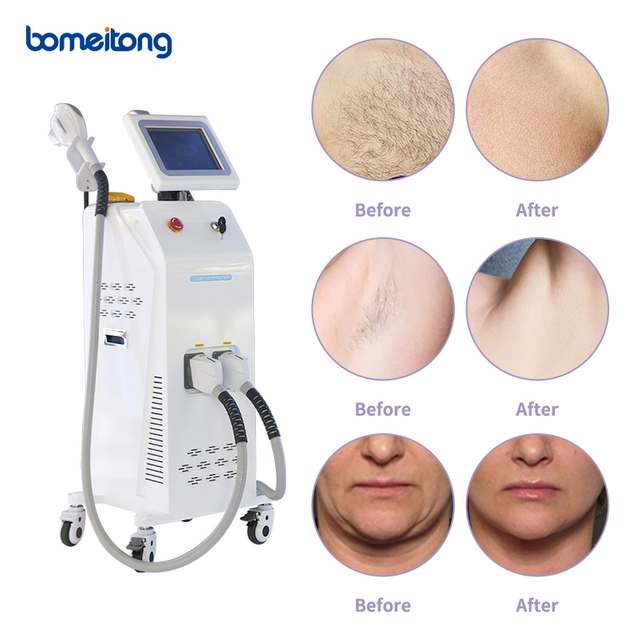 Armpit Laser Hair Removal Photo Rejuvenation Ipl Skin Rejuvenation