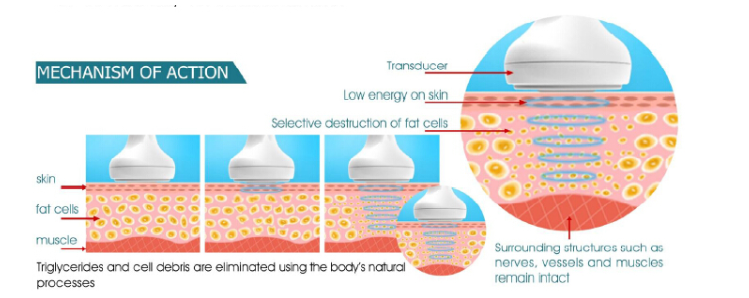 laser slimming machine