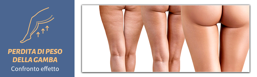 emsculpt weight loss