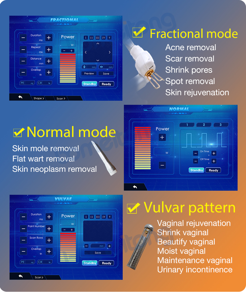 10600nm laser equipment
