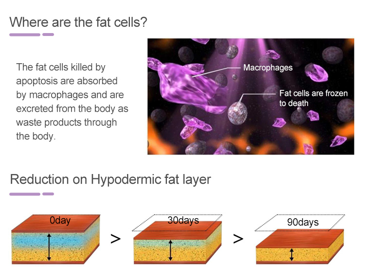 Cryolipolysis machine