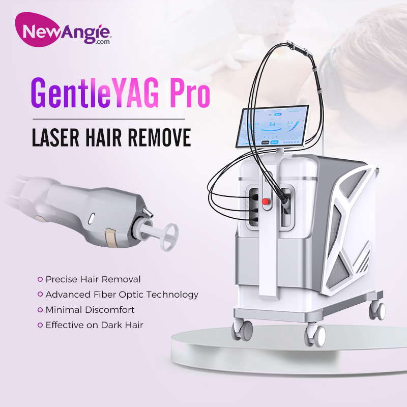alex nd yag laser hair removal