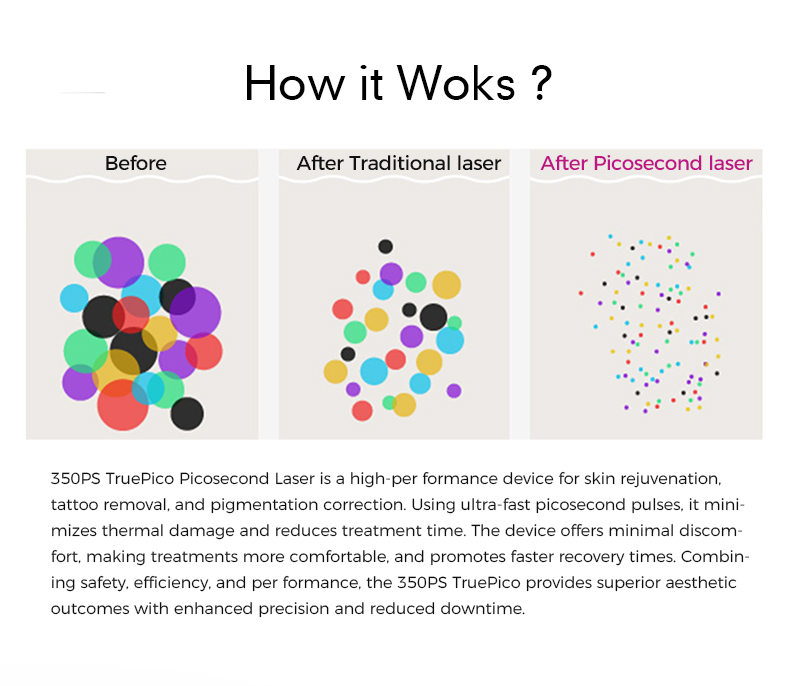 The 350ps True Pico Laser Treats Pigment Tattoos And Skin Issues