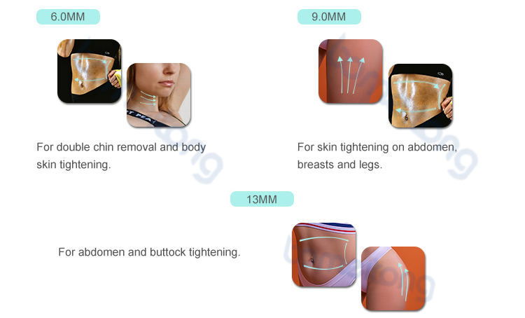 high intensity frequency ultrasound