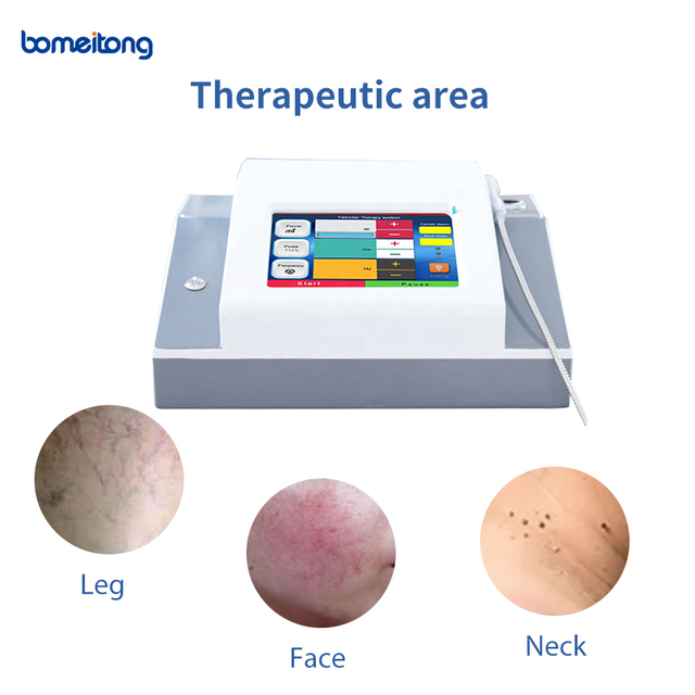 980nm Diode Laser Vescular Vein Removal Machine Spider Vein Amazon Ipl