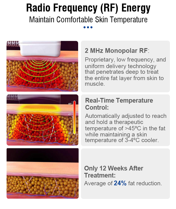 trusculpt skin tightening