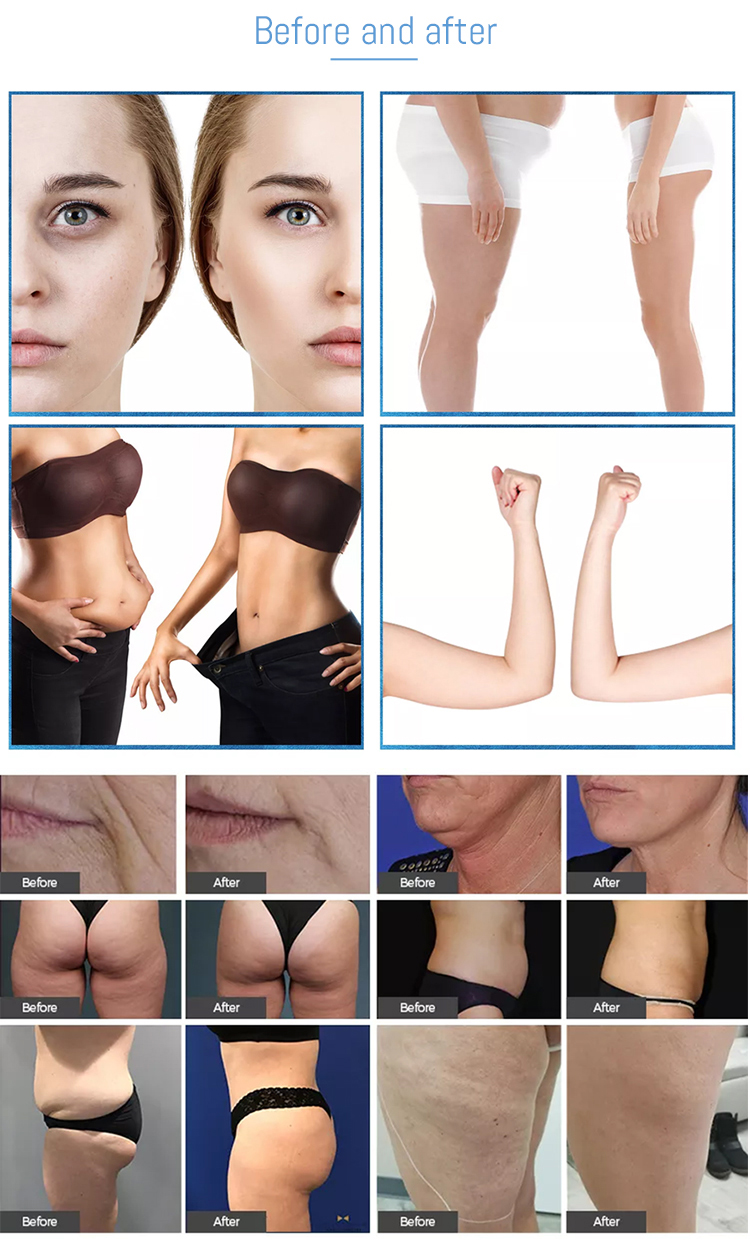 M9+6S滚轮按摩器详情_04