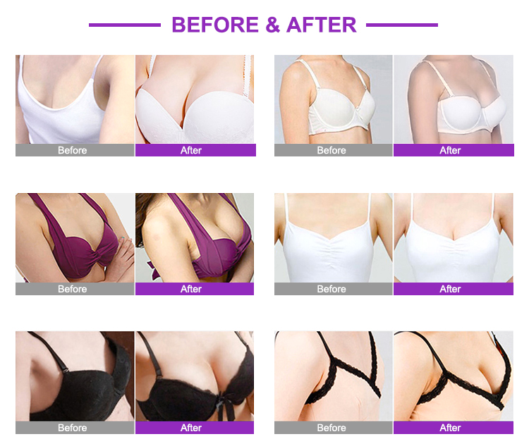 Vacuum Therapy Machine