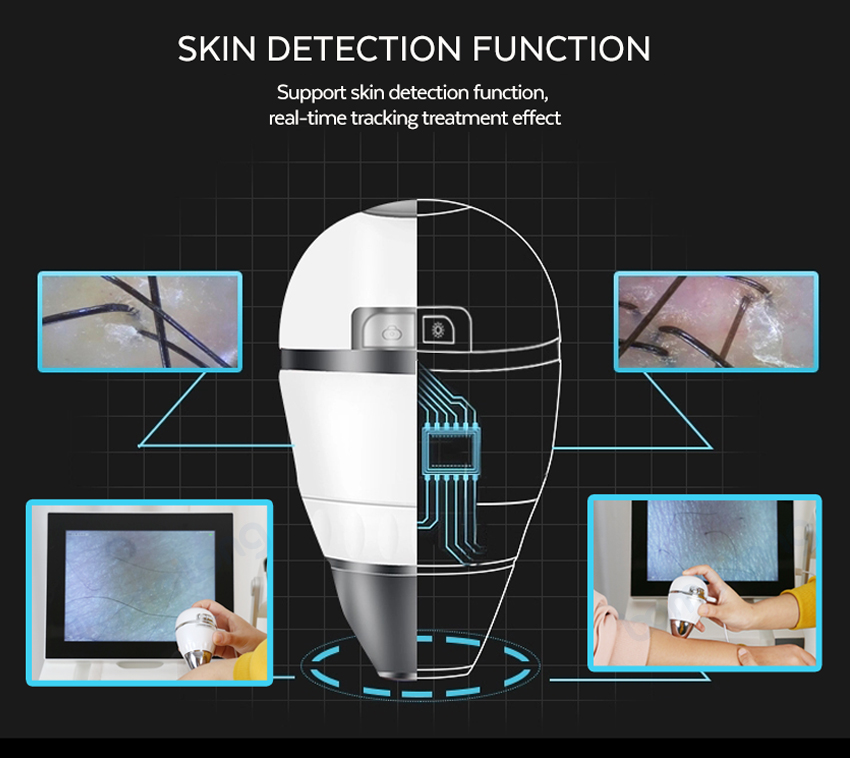 Laser hair removal diode machine 755 808 1064 3 wave wavelength professional