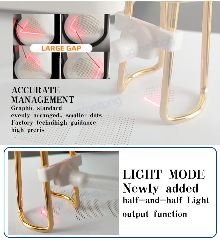 Laser Co2 Skin Resurfacing Facial Acne Scar Pore Speckle Removal Vaginal Tighten