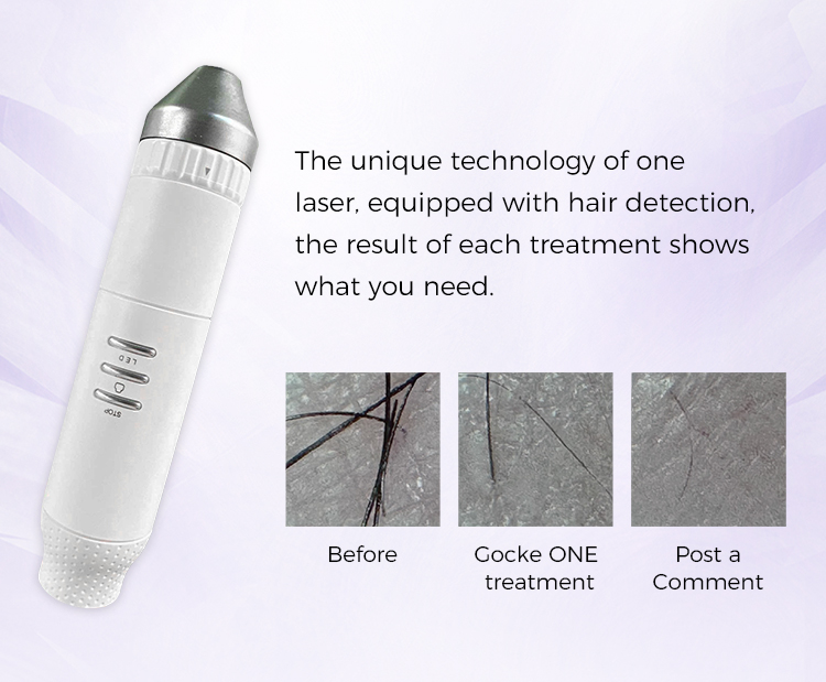 hair removal machine