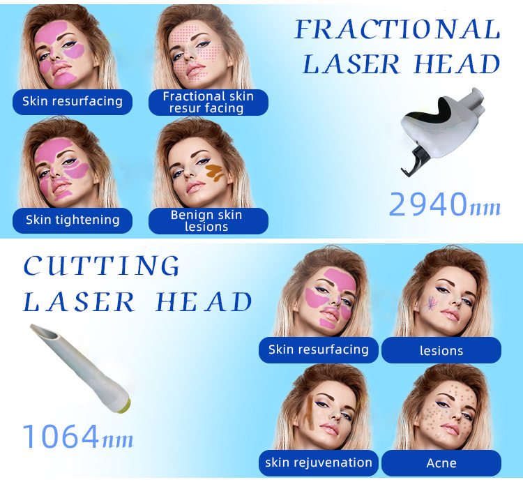 best fractional laser