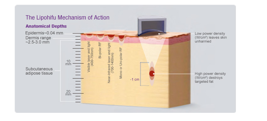 lipohifu machine for sale