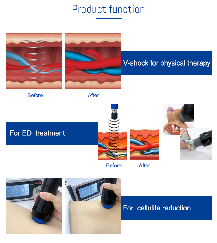shockwave therapy machine