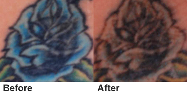 picosecond laser machine