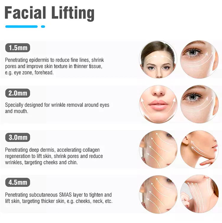 face lifting