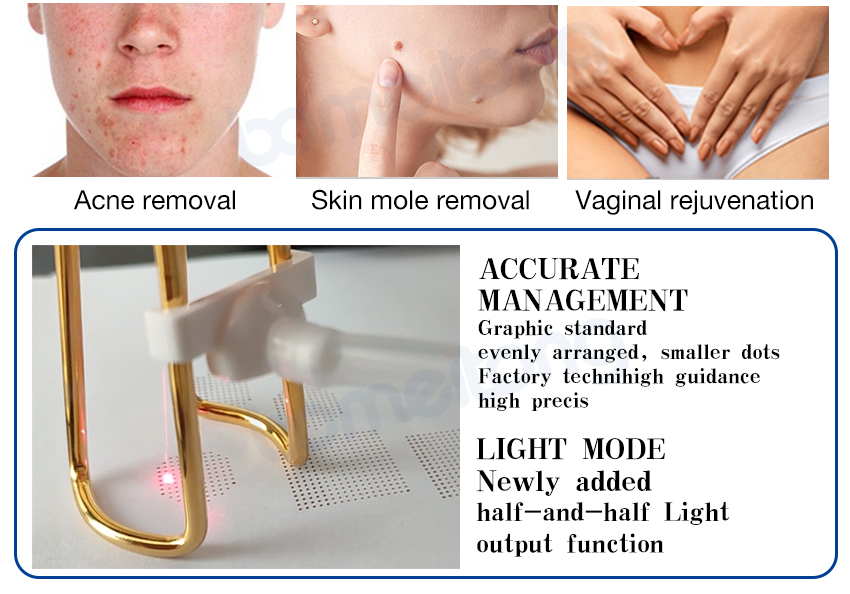 skin resurfacing 10600nm