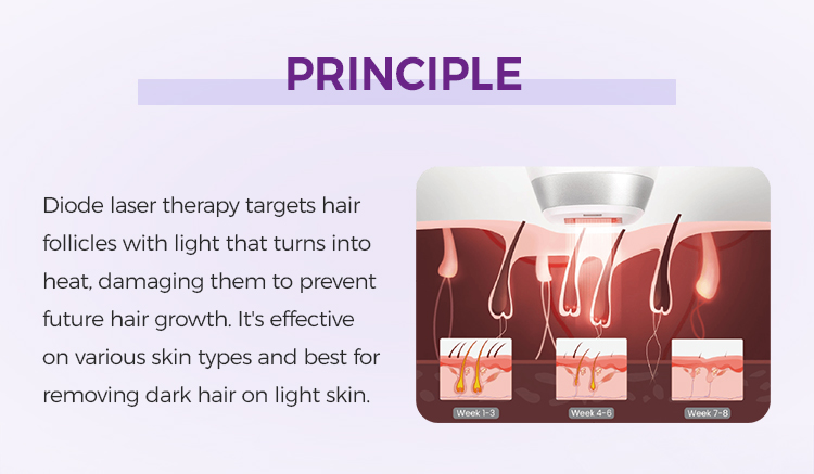 Professional Diode Ice Laser Hair Removal Machine And Equipment