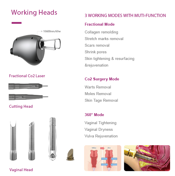 fractional co2 laser machine price