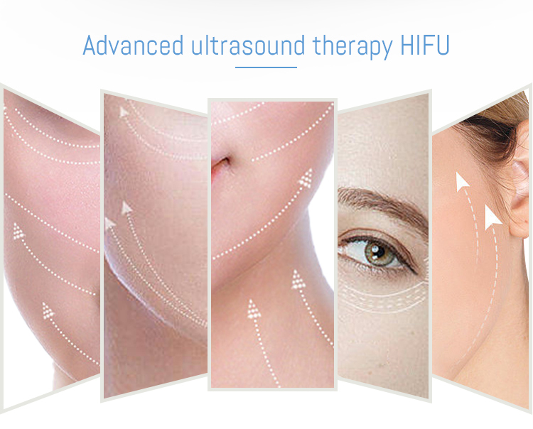 hifu machine non surgical face lift