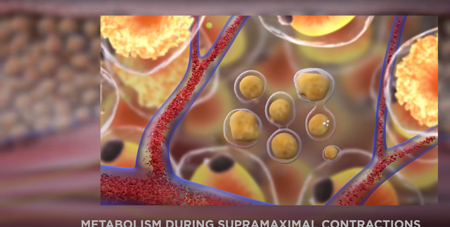 Body slimming machine