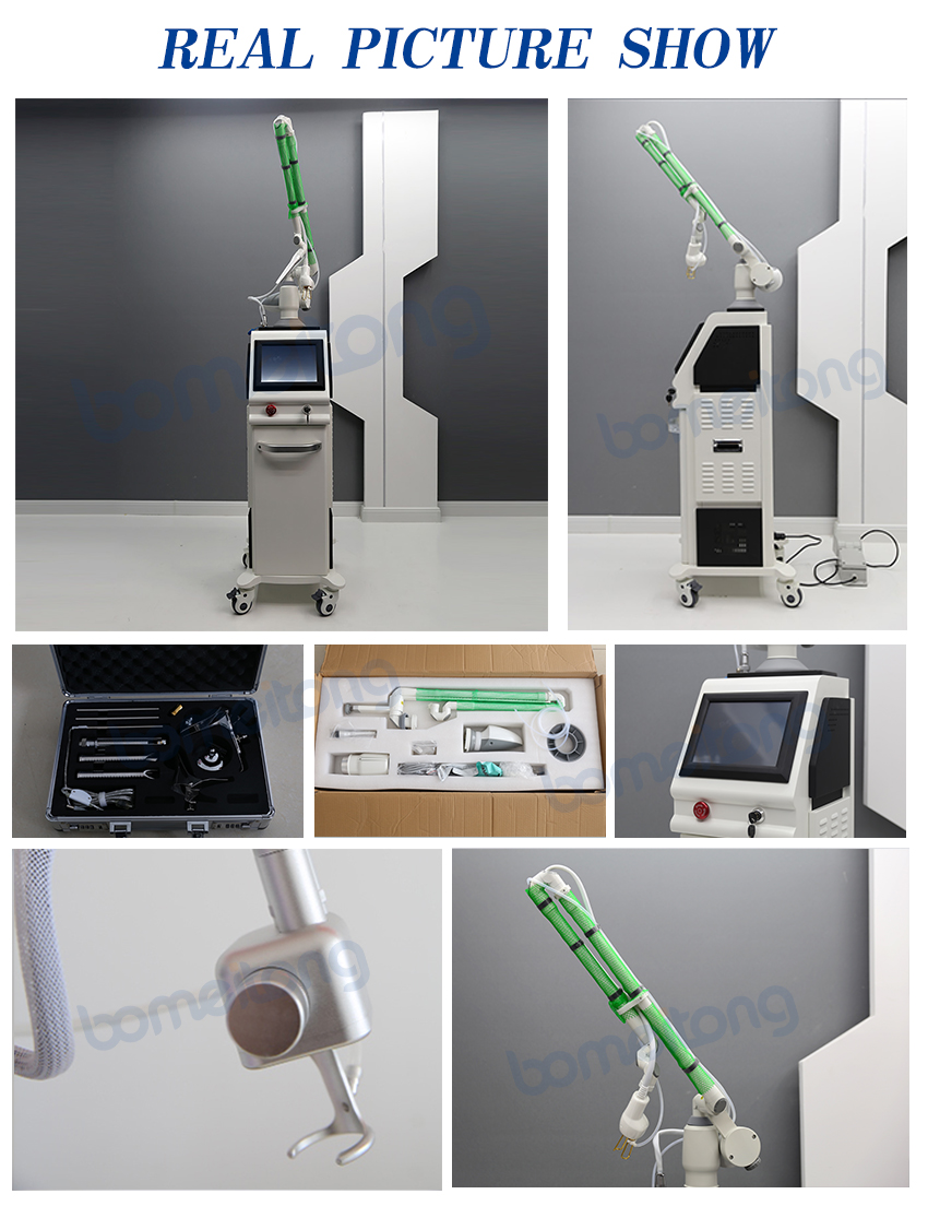 skin resurfacing 10600nmskin resurfacing 10600nm