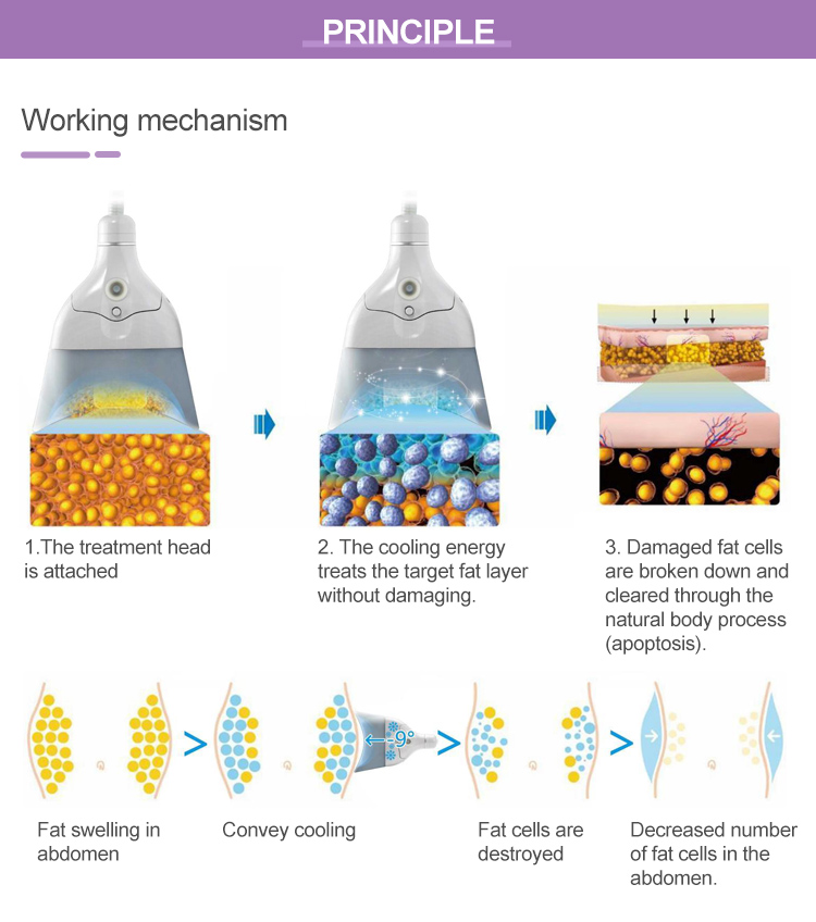 360 Degree Cooling Technology Cryolipolysis Slimming Machine Fat Freezing