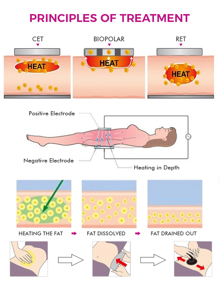 448K+20K Ret Cet Smart Tecar Physical Therapy Radiofrequency Pain Relief Slimming Machine
