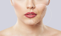 //ikrorwxhqkrili5q.ldycdn.com/cloud/lqBplKiolmSRilqkiippiq/what_is_pico_laser_treatment_9_5874e2c311.jpg