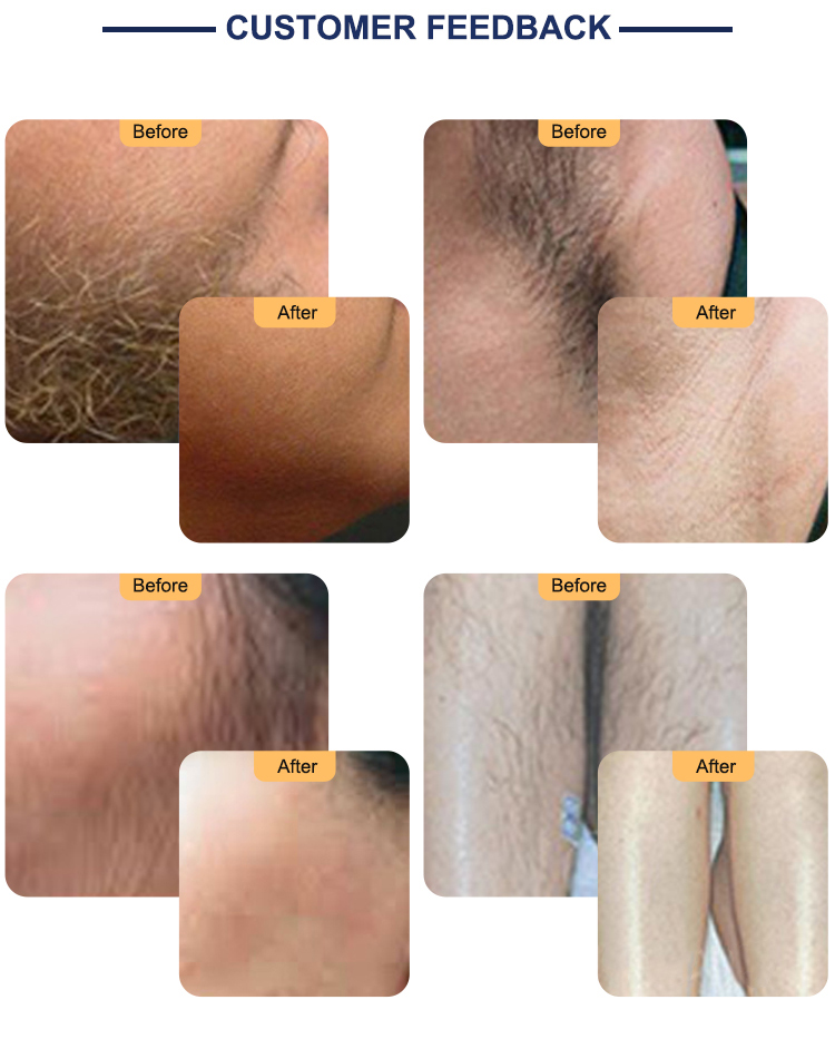 Best Price Intelligent Android System Skin Rejuvenation