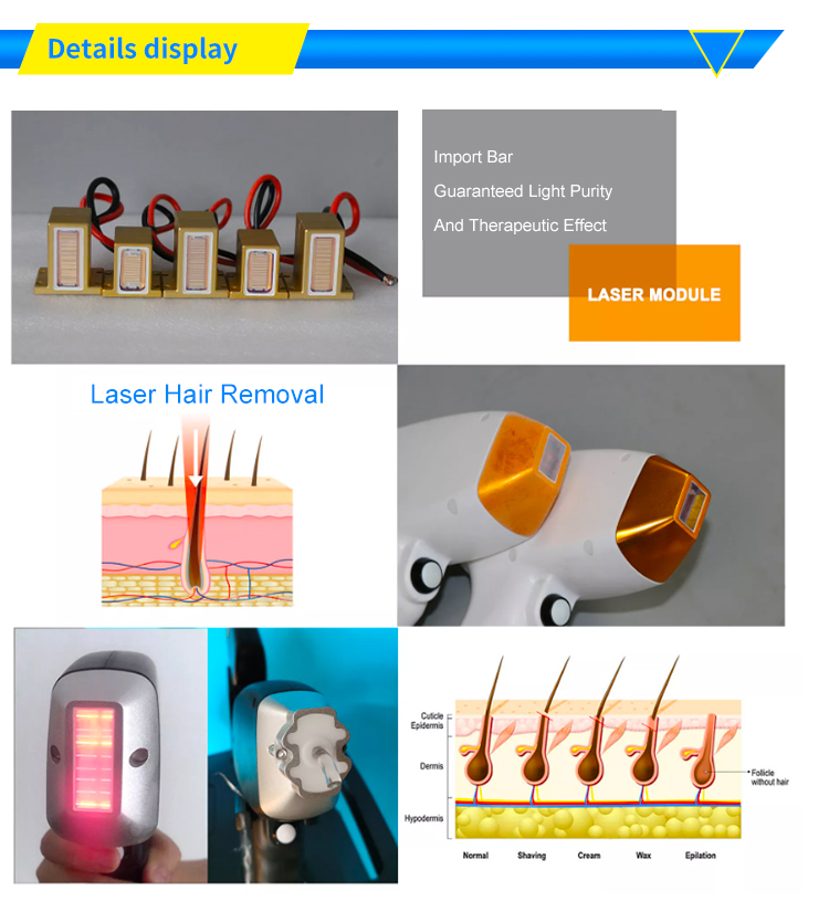 808 diode laser hair removal machine