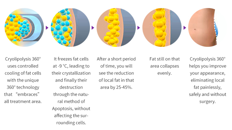 5 in 1 cavitation machine