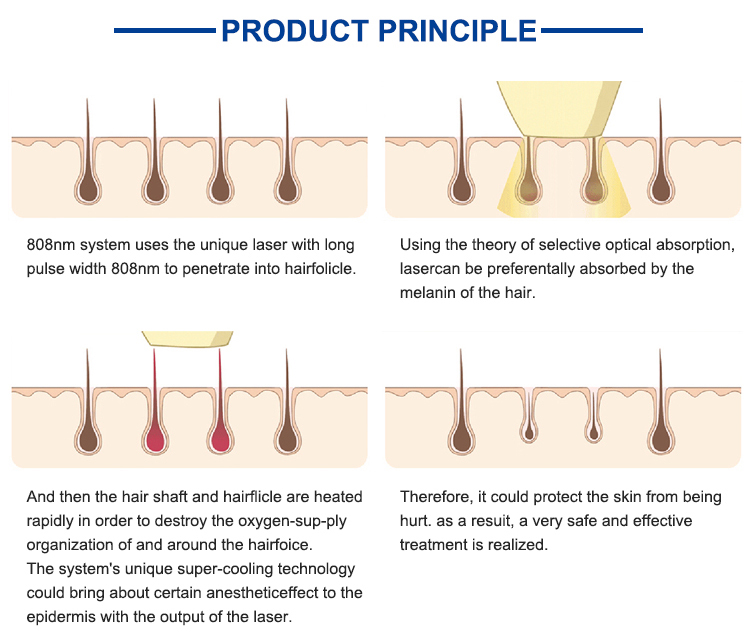 best facial hair removal machine for female