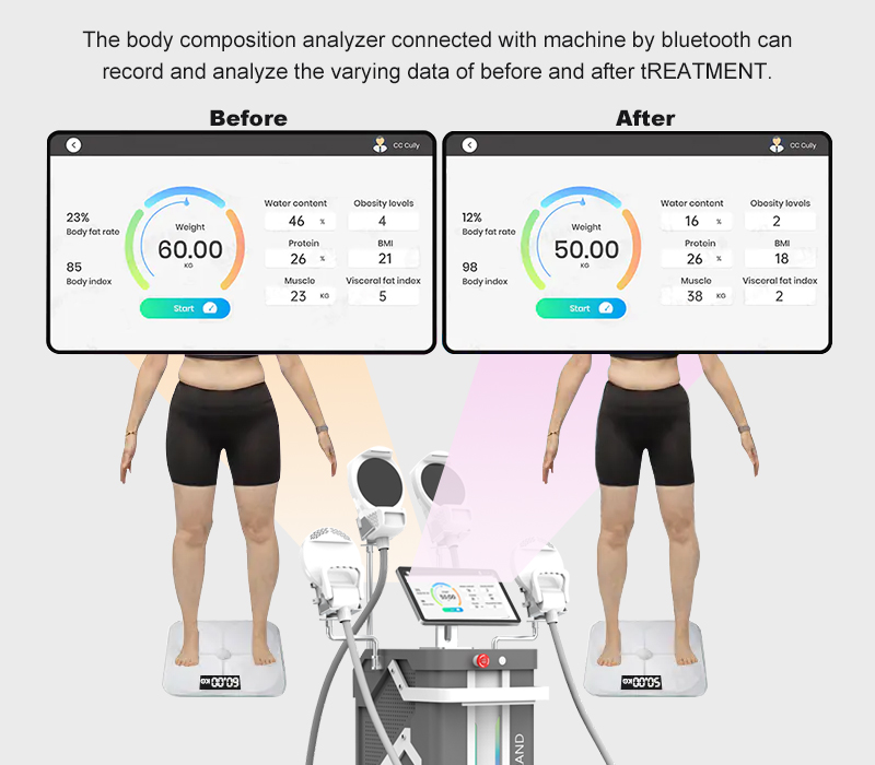 android HIEMT EMS smart body fat scale
