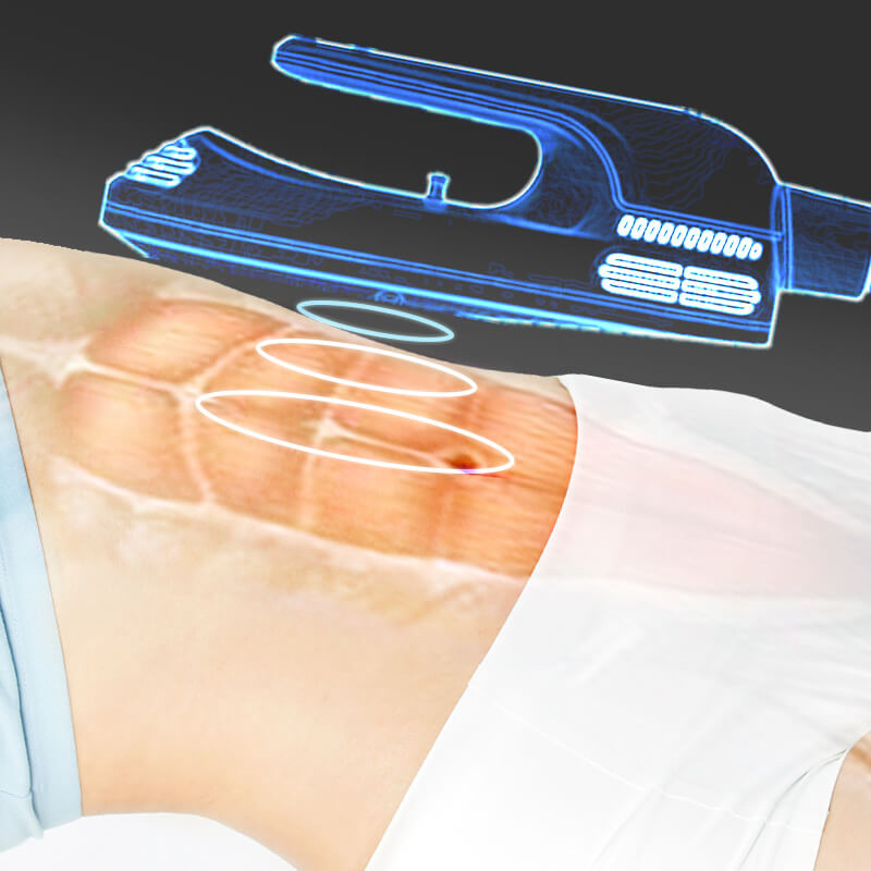 ems machine treatment effect