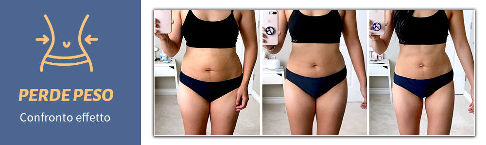 emsculpt body slimming