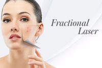 //ikrorwxhqkrili5q.ldycdn.com/cloud/lqBplKiolmSRrlmnmiiliq/al-qadi-medical-center-co2-fractional-laser-in-abu-dhabi-for-scars-1-in-al-khaleej-al-arabi-street-5.jpeg