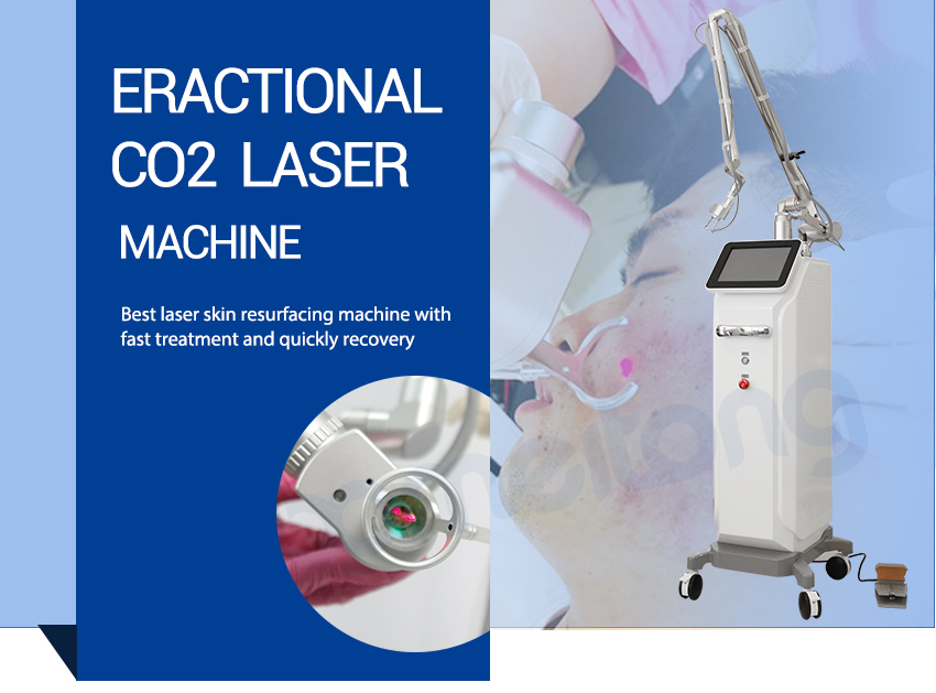 Fractional Co2 Laser Machine Cost Skin Resurfacing Acne Scars Stretch Marks Removal 